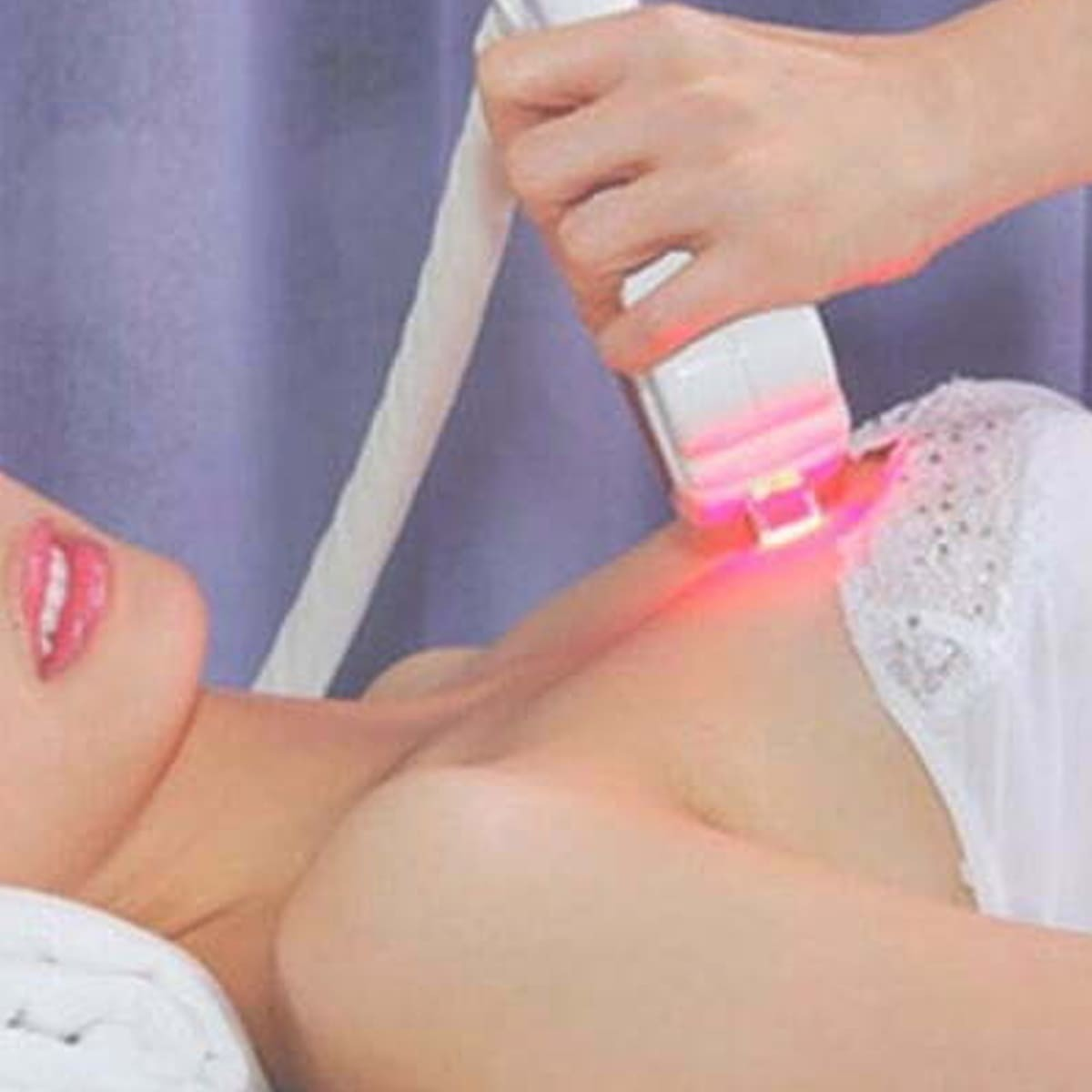 Làm hồng nhũ hoa bằng công nghệ RF