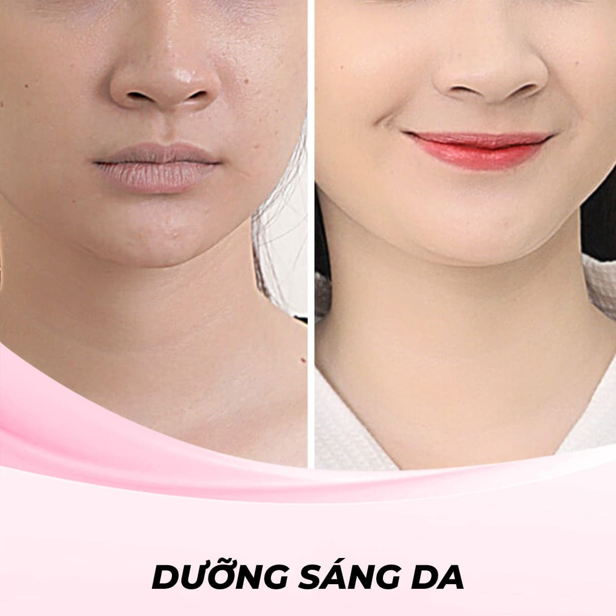 Dịch vụ Laser hút chì thải độc da mặt
