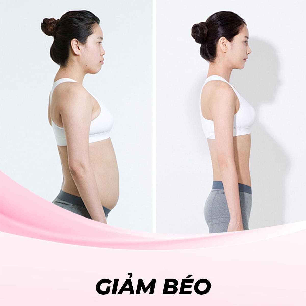 Giảm béo 3 vùng với công nghệ RF - liệu trình 10 buổi