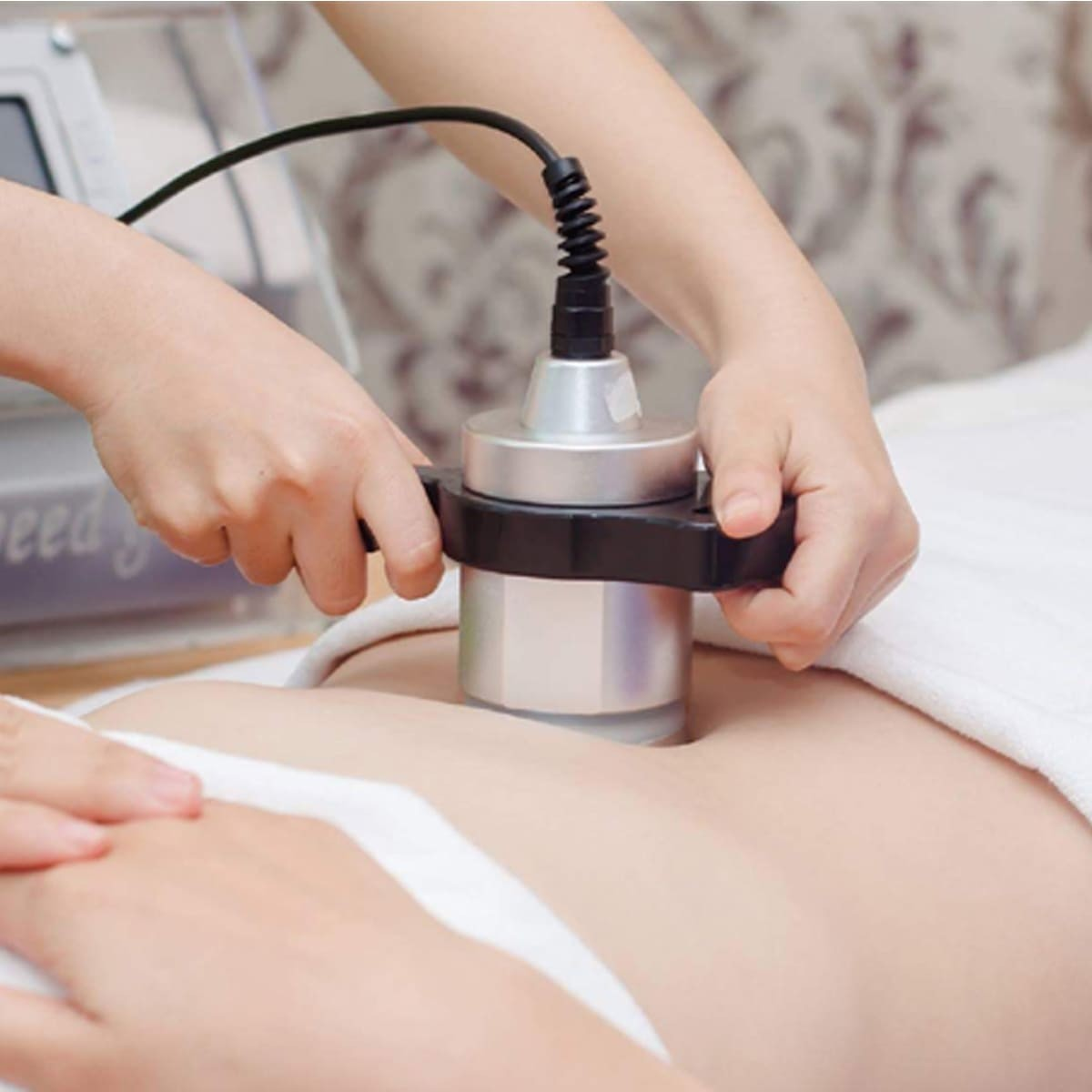 Giảm béo 3 vùng với công nghệ RF - liệu trình 10 buổi